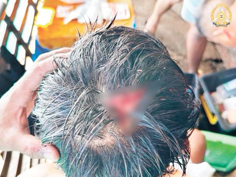 圖為一名菲律濱海軍人員在仁愛礁的遭遇事件中,聲稱遭中國海警用棍子擊傷頭部。(視頻截圖)